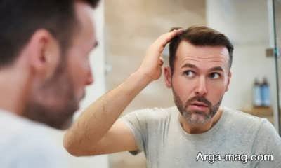 رنگ کردن مو بعد از کاشت
