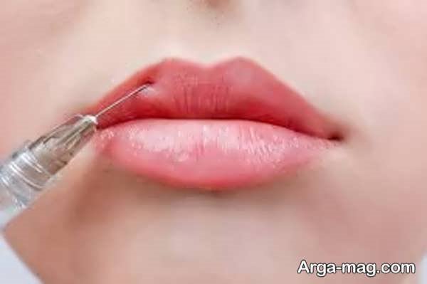 آیا تکنیک M برای شما مناسب است؟ بررسی مزایا و معایب
