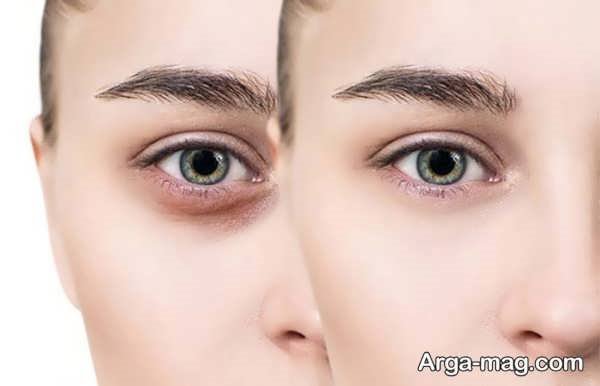 آموزش مرحله به مرحله آرایش کبودی زیر چشم