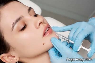 فیلر و راه های مراقبت های بعد از آن