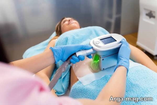 آیا روش کرایولیپولیز واقعاً مؤثر است؟ همه چیز درباره این روش لاغری مدرن