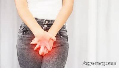  تشخیص زگیل تناسلی