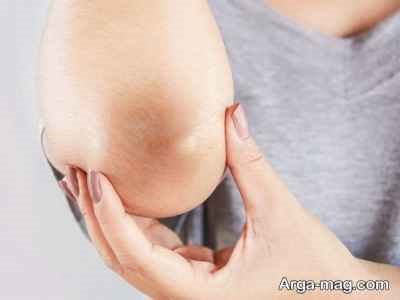 تعابیر سیاه شدن پوست