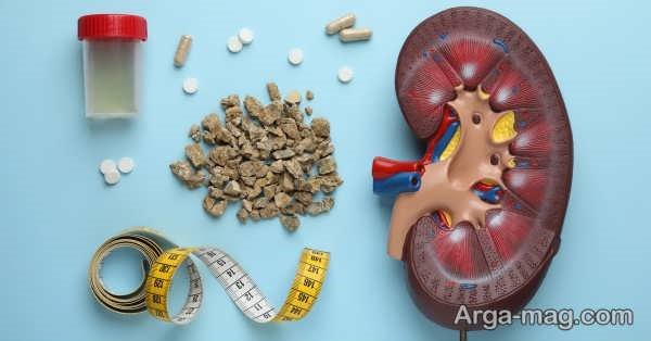 تأثیر قهوه روبوستا برای سلامتی