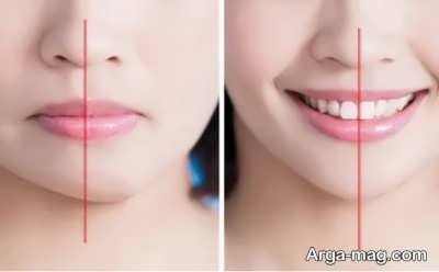 جراحی ژینوپلاستی