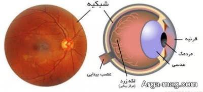 امراض شبکیه چشم