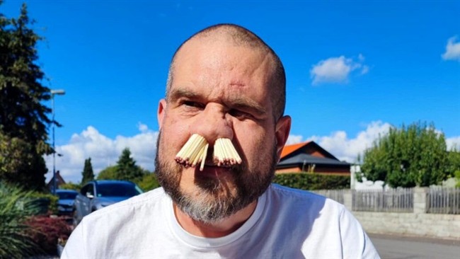 عجیب ترین رکوردهای گینس 2025؛ از نگه داشتن چوب کبریت در بینی تا خوک اسکیت‌باز